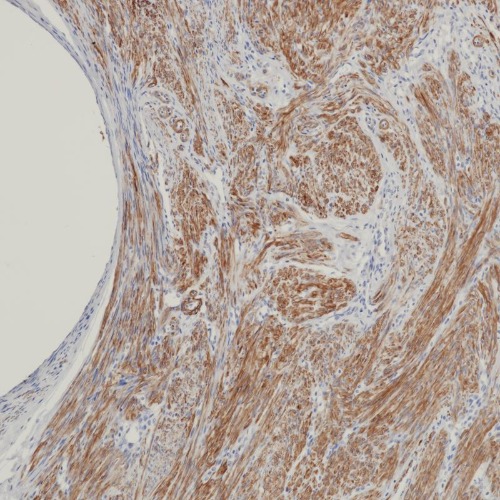 Caldesmon Mouse Monoclonal Antibody(ARB886)