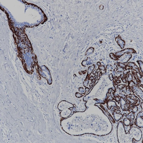 Calponin Rabbit Monoclonal Antibody(ARB887)