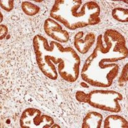 Calreticulin Rabbit Monoclonal Antibody(ARB888)