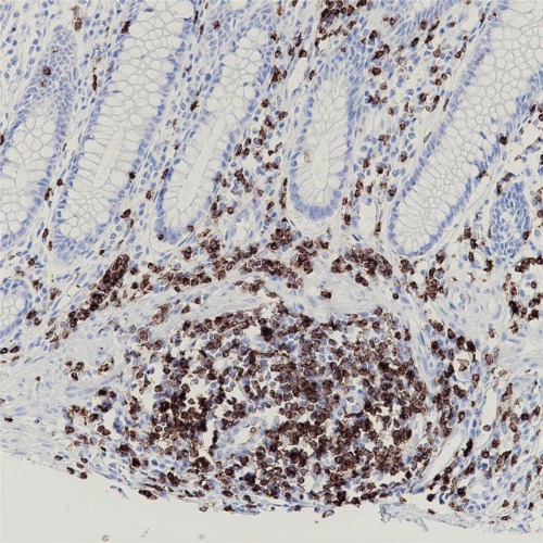 CD2 Rabbit Monoclonal Antibody(ARB895)