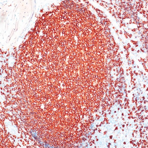 CD20 Rabbit Monoclonal Antibody(ARB896)