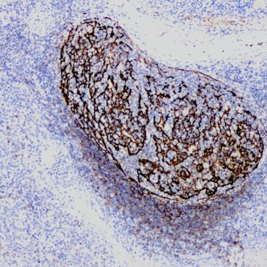 CD21 Rabbit Monoclonal Antibody(ARB898)