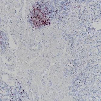 CD23 Rabbit Monoclonal Antibody(ARB899)