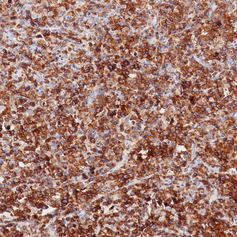 CD25 Rabbit Monoclonal Antibody(ARB900)