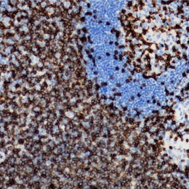 CD3 Rabbit Monoclonal Antibody(ARB901)