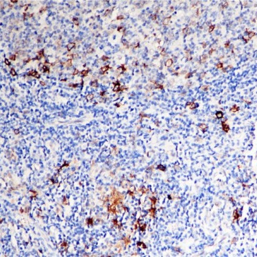 CD30 Rabbit Monoclonal Antibody(ARB902)