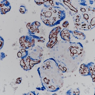 CD31 Rabbit Monoclonal Antibody(ARB903)
