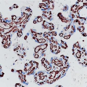 CD34 Rabbit Monoclonal Antibody(ARB904)