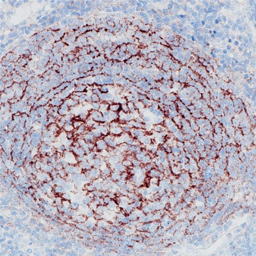 CD35 Rabbit Monoclonal Antibody(ARB905)