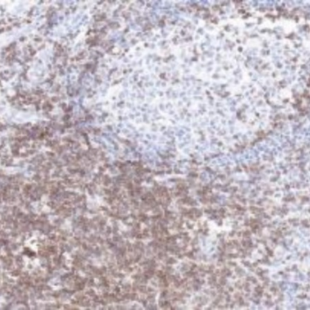 CD3D Rabbit Monoclonal Antibody(ARB907)