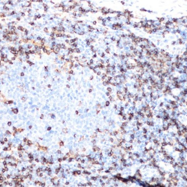 CD4 Rabbit Monoclonal Antibody(ARB909)