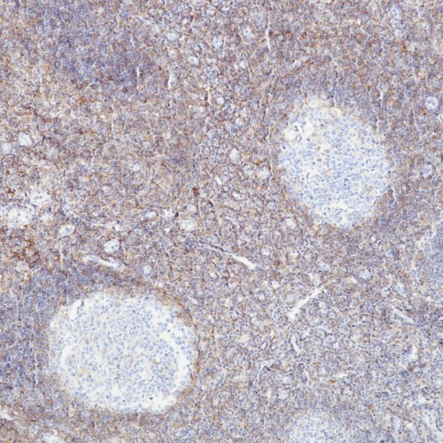 CD44 Rabbit Monoclonal Antibody(ARB910)