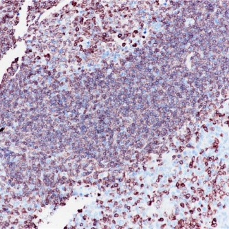 CD79a Rabbit Monoclonal Antibody(ARB914)