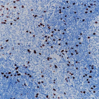 CD8 Rabbit Monoclonal Antibody(ARB915)
