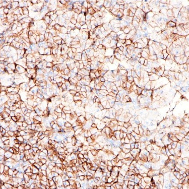 CD99 Rabbit Monoclonal Antibody(ARB916)