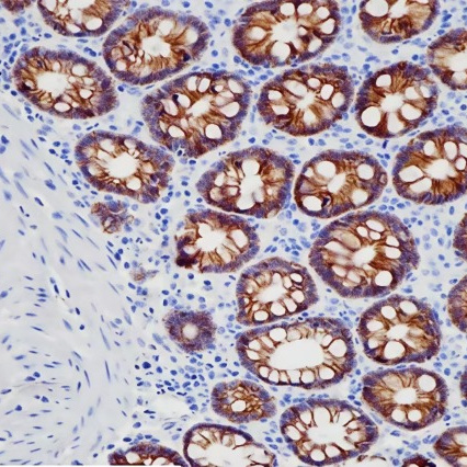 CDH17 Rabbit Monoclonal Antibody(ARB917)