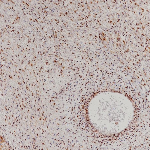 CDK4 Rabbit Monoclonal Antibody(ARB918)