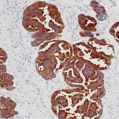 Claudin 6 Rabbit Monoclonal Antibody(ARB921)