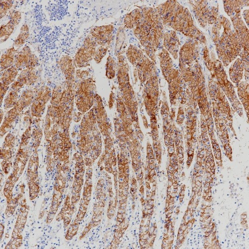 Claudin18.2 Rabbit Monoclonal Antibody(ARB922)