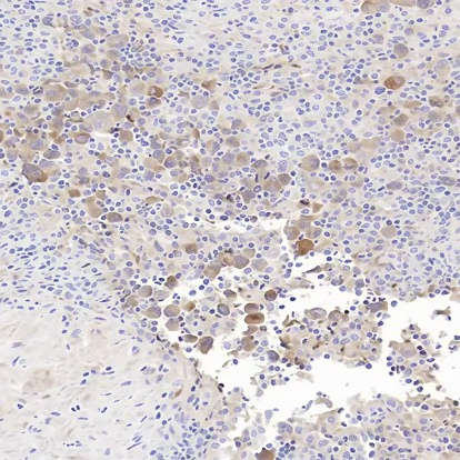 Clusterin Rabbit Monoclonal Antibody(ARB924)