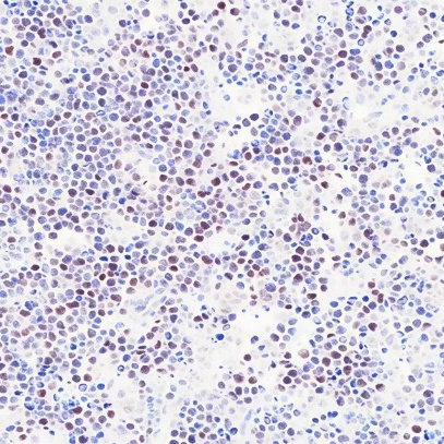 c-Myc Rabbit Monoclonal Antibody(ARB925)
