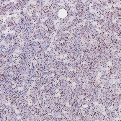 c-Myc Rabbit Monoclonal Antibody(ARB926)