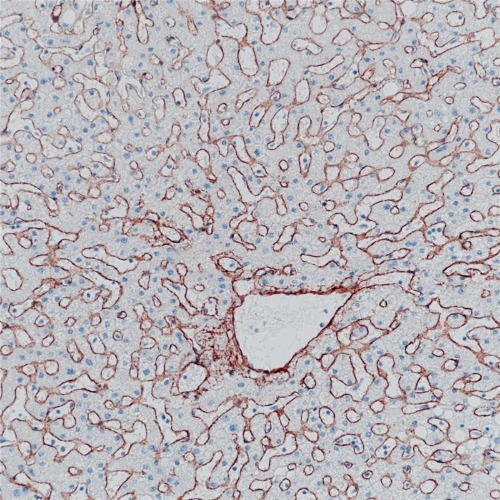 Collagen Ⅳ Rabbit Monoclonal Antibody(ARB929)