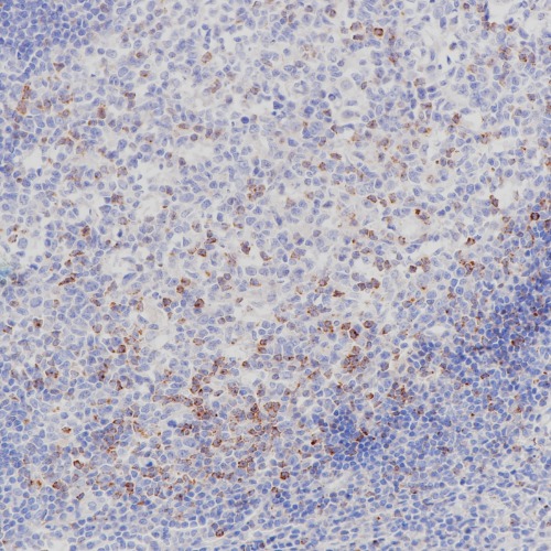 CTLA-4 Rabbit Monoclonal Antibody(ARB930)