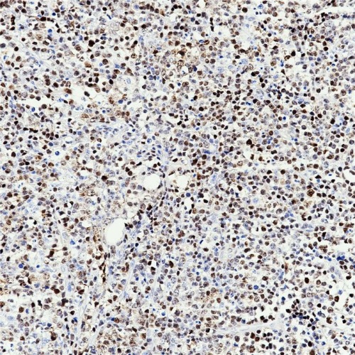 Cyclin D1 Rabbit Monoclonal Antibody(ARB932)