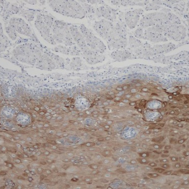 Cytokeratin 1 Rabbit Monoclonal Antibody(ARB933)