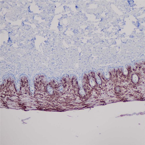 Cytokeratin 10 Rabbit Monoclonal Antibody(ARB934)