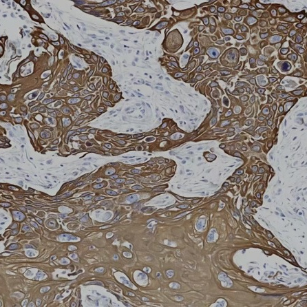 Cytokeratin 17 Rabbit Monoclonal Antibody(ARB936)