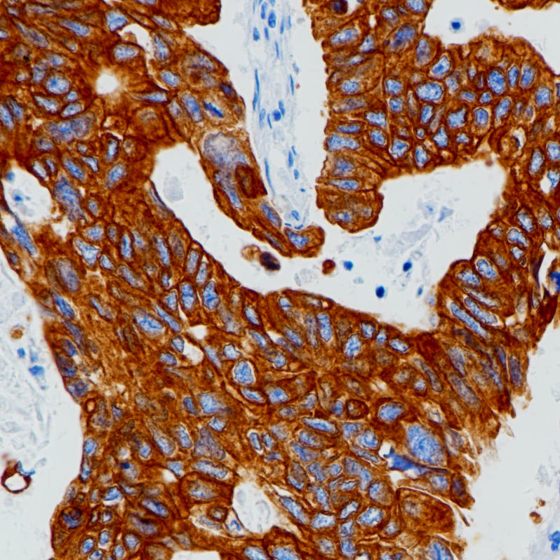 Cytokeratin 19 Rabbit Monoclonal Antibody(ARB937)