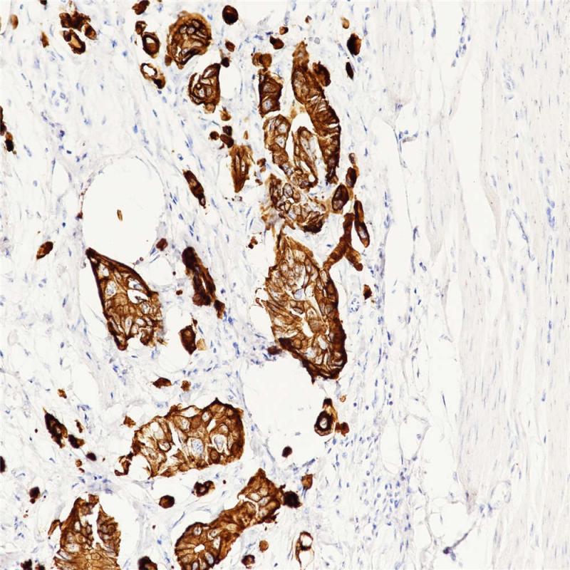 Cytokeratin 5 Rabbit Monoclonal Antibody(ARB939)