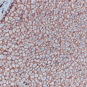 E-Cadherin Rabbit Monoclonal Antibody(ARB945)