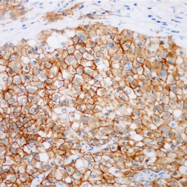 EGFR Rabbit Monoclonal Antibody(ARB946)