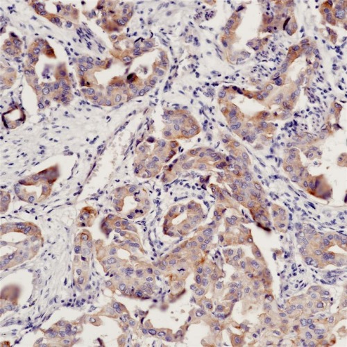 EGFR(L858R) Rabbit Monoclonal Antibody(ARB947)