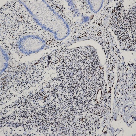 ERG Rabbit Monoclonal Antibody(ARB949)