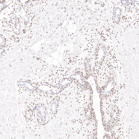 Estrogen receptor beta Rabbit Monoclonal Antibody(ARB950)