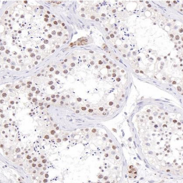 EZH2 Rabbit Monoclonal Antibody(ARB951)