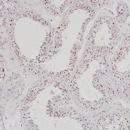 EZHIP Rabbit Monoclonal Antibody(ARB952)