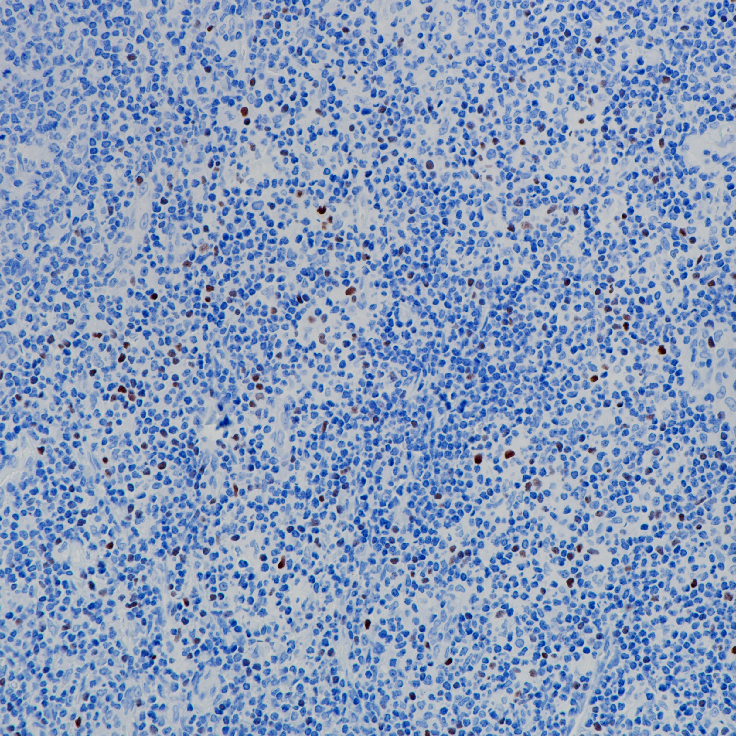 FOXP3 Rabbit Monoclonal Antibody(ARB954)