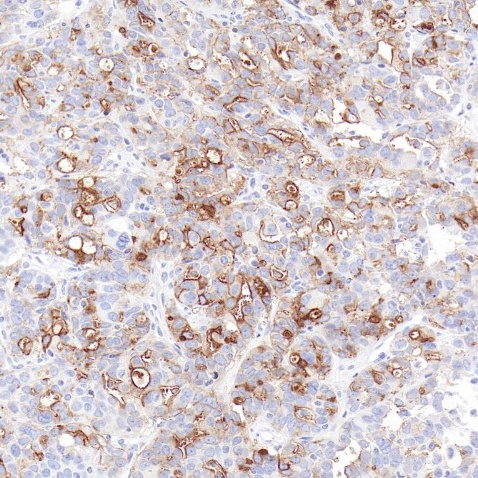 FR&alpha; Rabbit Monoclonal Antibody(ARB955)