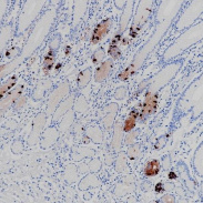 Gastrin Rabbit Monoclonal Antibody(ARB956)