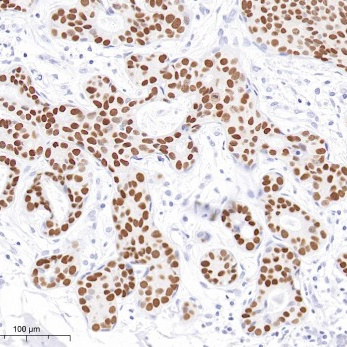 GATA-3 Rabbit Monoclonal Antibody(ARB957)