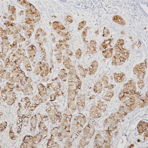 GCDFP-15 Rabbit Monoclonal Antibody(ARB958)