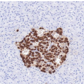 Glucagon Rabbit Monoclonal Antibody(ARB960)
