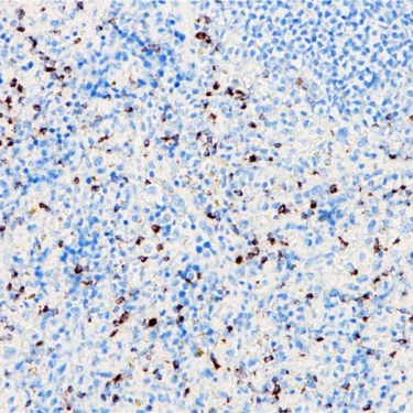 Granzyme B Rabbit Monoclonal Antibody(ARB962)