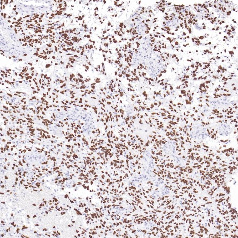H3K27M Rabbit Monoclonal Antibody(ARB964)