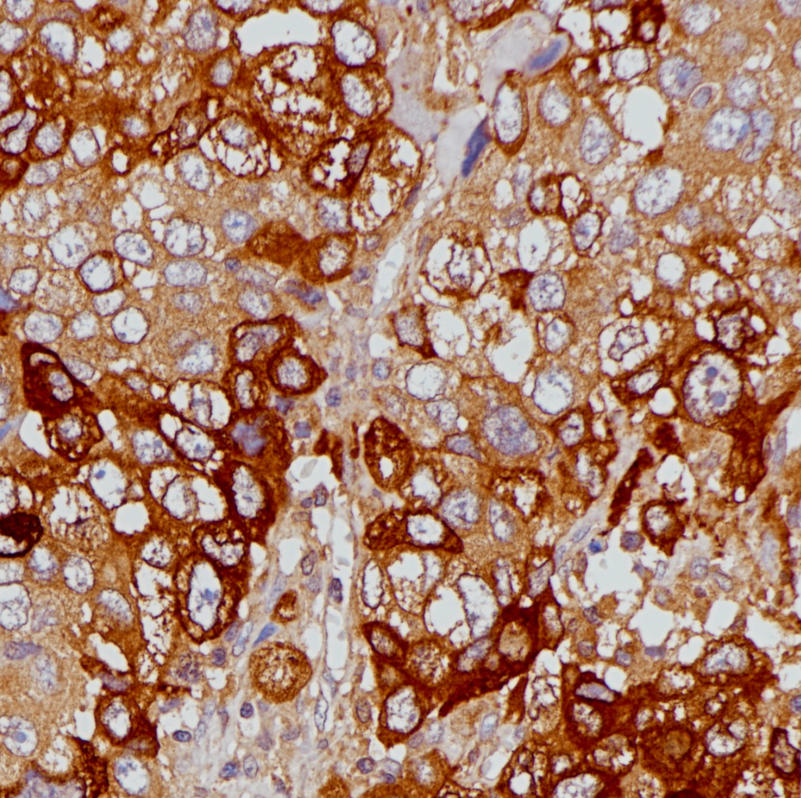 hCG Rabbit Monoclonal Antibody(ARB966)